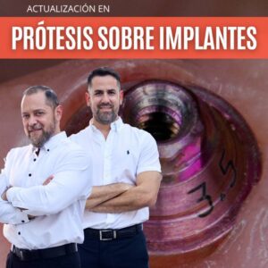 PRÓTESIS SOBRE IMPLANTES: El Paso a Paso - Dr. Juan Ignacio Bejarano y Prof. Dr. Rubén Ayala Semidei [Cuota 1/4]