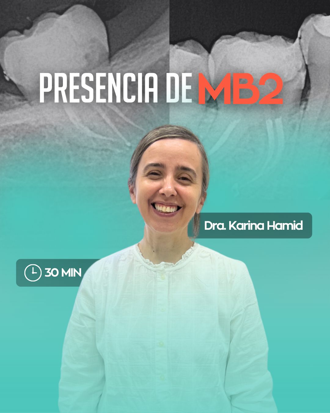 ¿Cómo identificar la presencia del Mb2? con la Dra. Karina Hamid